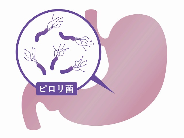 ピロリ菌による健康への影響